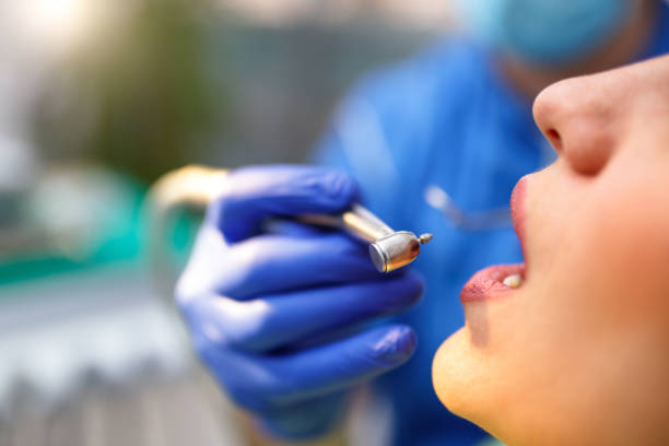 Best Wisdom Tooth Removal  in Morse, LA